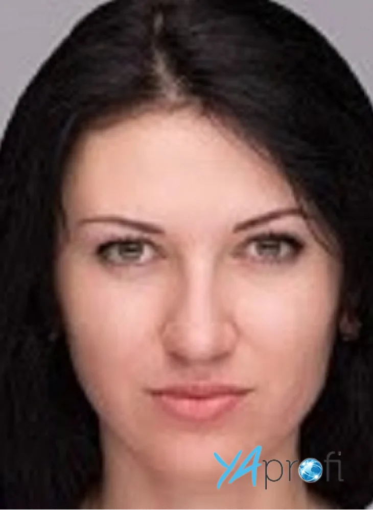 Штельмах Виктория (Milner-Medical)